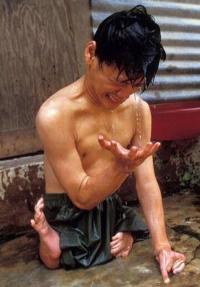 nạn nhân chất độc da cam