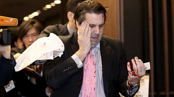 https://abcnews.go.com/International/mark-lippert-ambassador-unarmed-guard/story?id=29413198
