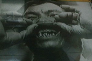 Miệng ông Vũ Minh Tằng bị Bảy Nhu khoang